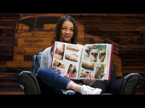 Cold burns a focus for Burn Awareness Week