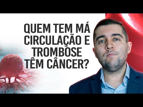 Qual a relação entre má circulação, trombose e embolia com câncer? Quando se preocupar e qual risco?