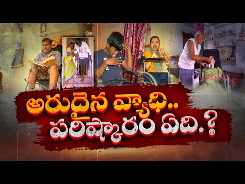 Muscle Atrophy Disease | There is No Proper Treatment & Medicine for This | Doctors || Idi Sangathi Teluguvoice