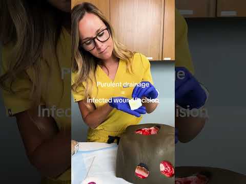 Wound Care Tips 🩹#shorts  #nclex #nursingnotes #nurseinthemaking