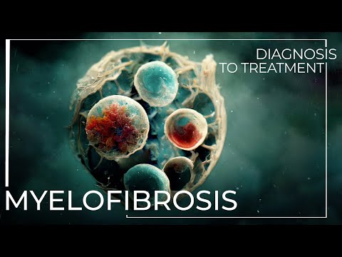 Is Myelofibrosis Cancer Curable?