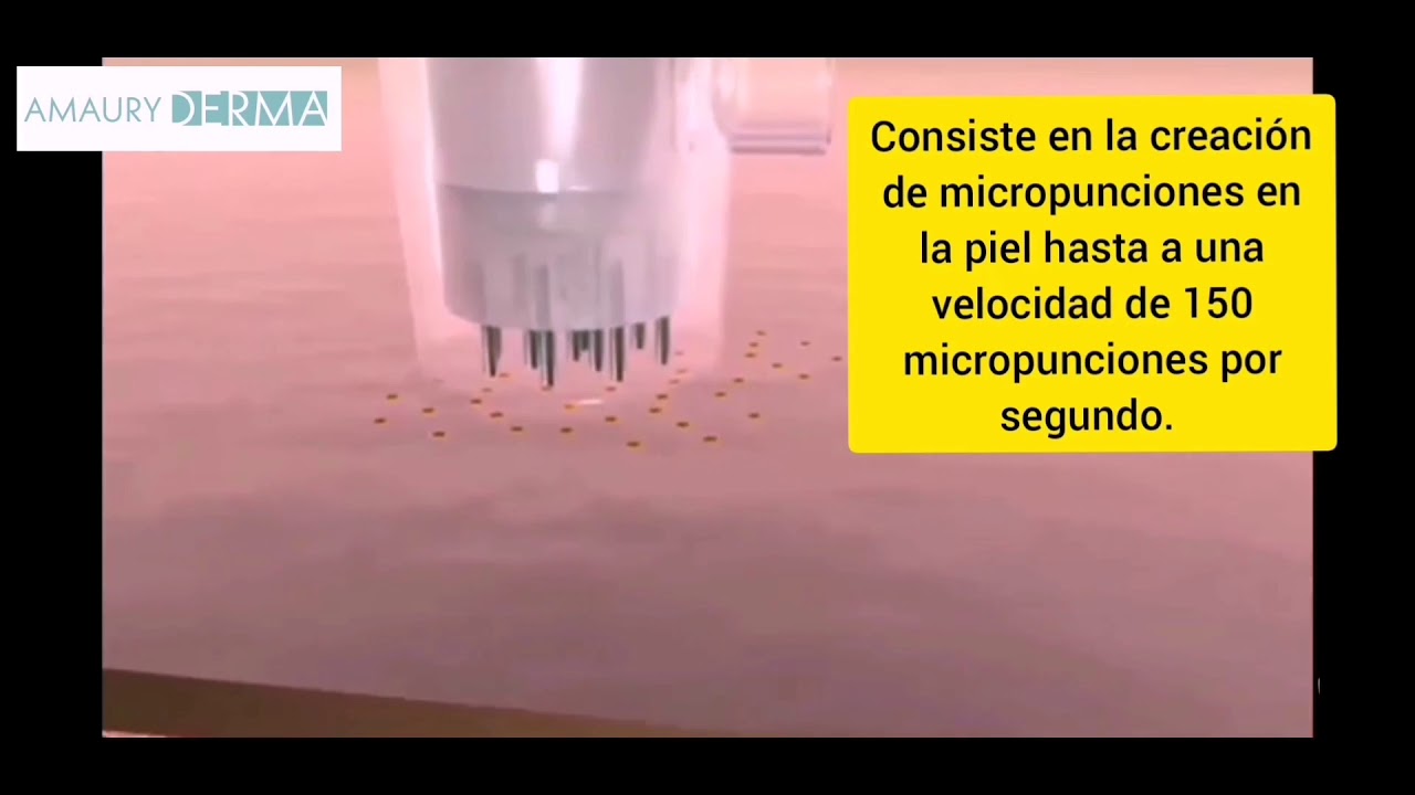 Víctor Amaury Rangel Avilés-45