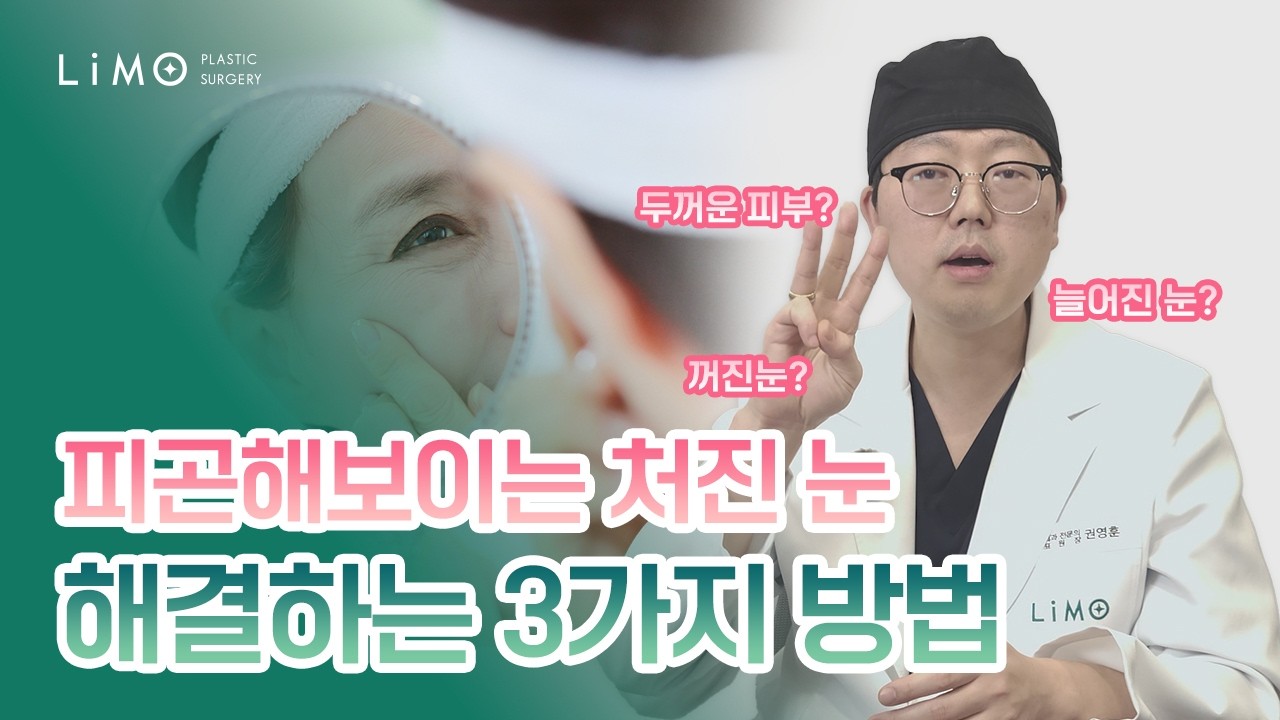 리모성형외과 유튜브 영상