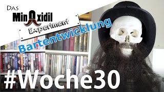 Das Minoxidil Experiment #Woche30  Bartentwicklung und Statusbericht