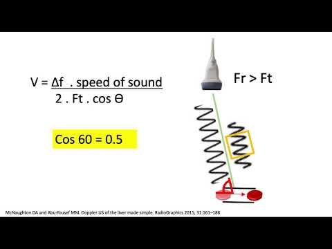 Ultrasound Doppler angle simplified