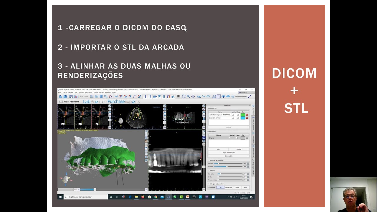 O QUE É DICOM E STL