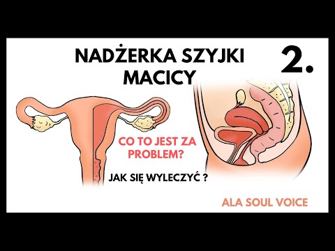 2.NADŻERKA SZYKI MACICY.CO TO JEST? oraz JAK SIĘ WYLECZYĆ?