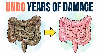 Gut Detox: How To Repair & Clean Your Gut Naturally