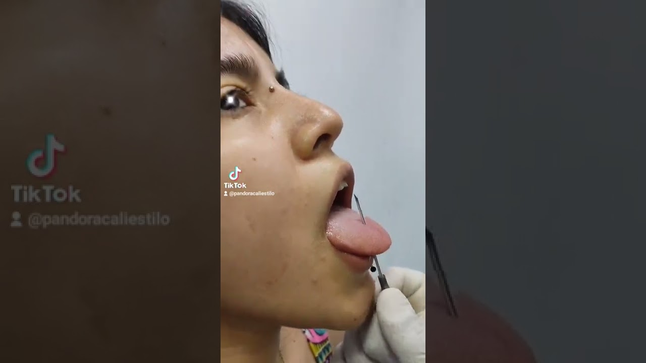 Watch piercing lengua vertical . sin anestesia . Colombia - cali Now piercing lengua vertical . sin anestesia . Colombia - cali
