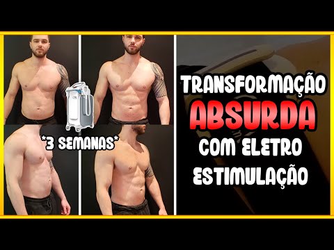 ELETROESTIMULAÇÃO MUSCULAR ANTES E DEPOIS!! *relato cm slim*