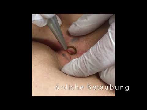 Nachdem krank nicht gedreht fallen und wunder Hals Chiropraktik und Osteochondrose Bewertungen