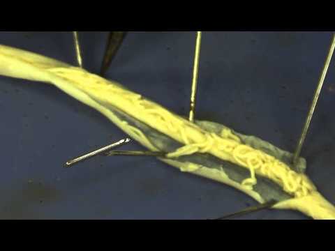 Medicina per forum di vermi Come togliere intestini da vermi