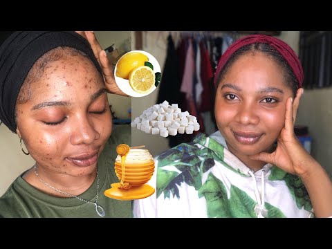 download lagu mp3 mp4 Black Spots In Sugar, download lagu Black Spots In Sugar gratis, unduh video klip Black Spots In Sugar