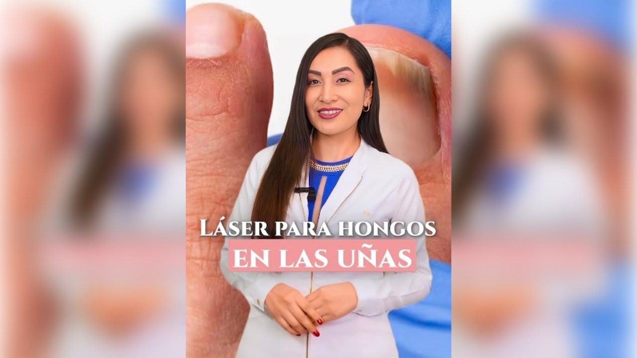 ✨¿Cómo tratar los hongos de las uñas con láser ?✨ -  Dra. Gisela Pilar Aire Farfán