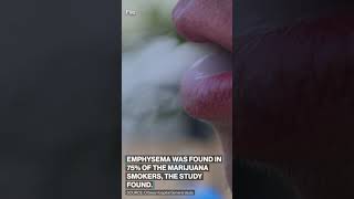 Download lagu Smoking #marijuana may be more harmful to lungs than smoking #cigarettes, study finds. #health mp3