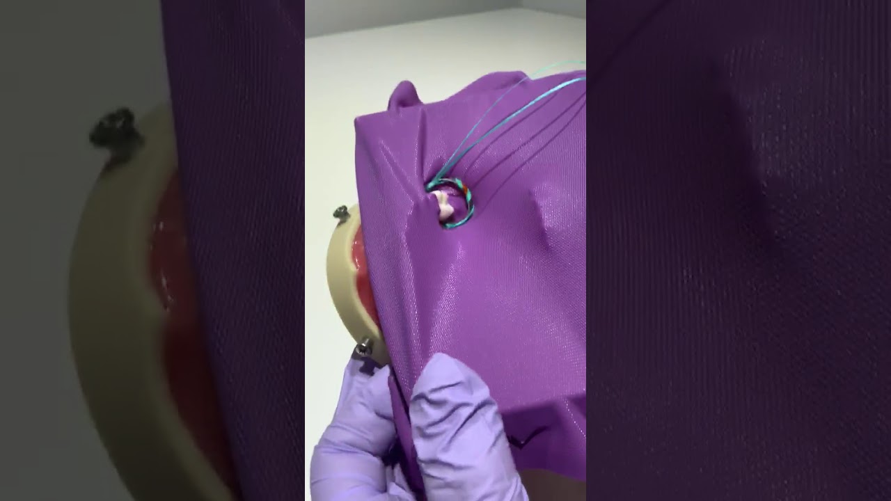 Cas d'usage avec la digue dentaire Hygenic Flexi Dam Coltene