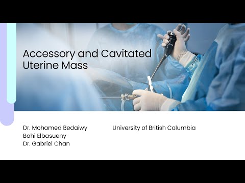 Palpable Uterine Mass: A Complex Gynecological Condition | Vibepedia
