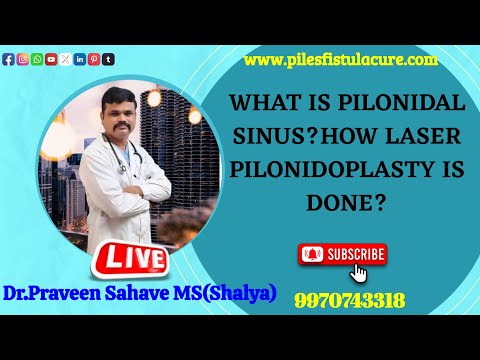 WHAT IS PILONIDAL SINUS?HOW LASER TREATMENT IS DONE?