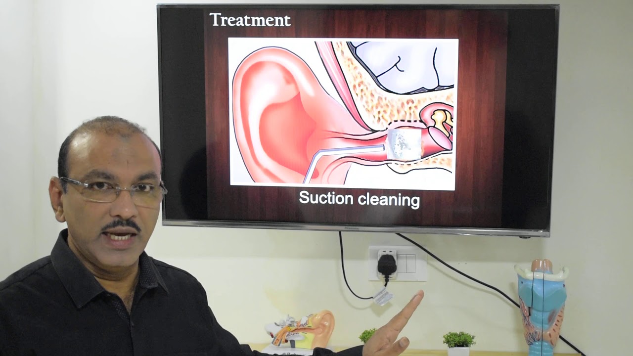 Fungal infection of ear (Malayalam) Patient teaching programme