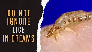 🐜Dreaming Of Lice Interpretation | Symbolism Of Lice Dreams | Lice Dream Dictionary