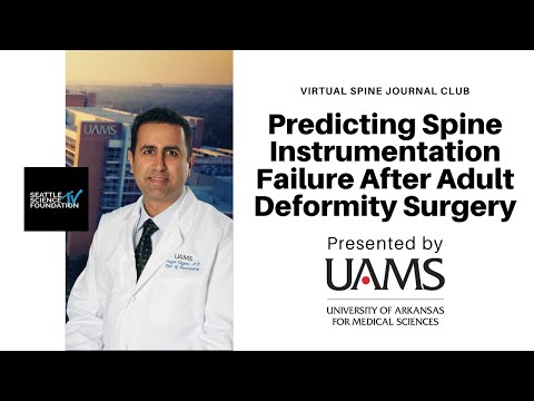Predicting Spine Instrumentation Failure After Adult Deformity Surgery - Noojan Kazemi, M.D. & UAMS