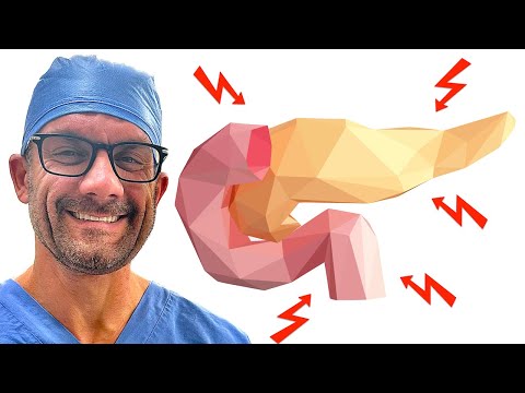 Understanding Acute Pancreatitis: A Simple Guide