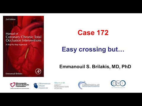 Case 172: Manual of CTO PCI - Easy crossing, but...