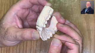 Download lagu FF025: labial arch construction for orthodontic removable appliances; Hawley retainer after braces mp3