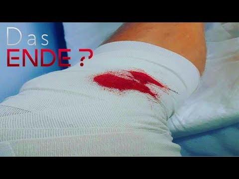 Milch und Salz aus Gelenken Das Knie emerte Preis
