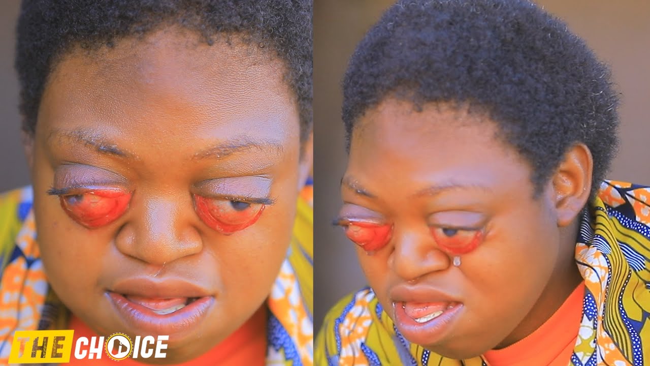 Umwana wange musiga mu nzu wenyine atinya kujya hanze batamuseka||bambwiye ko azapfa kubera amaso