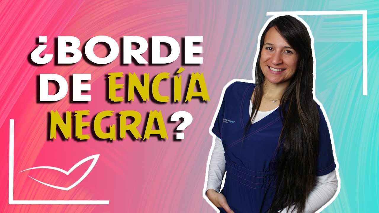 Watch Encías negras al rededor de coronas y carillas dentales l Bordes de encías con lineas negras Now Encías negras al rededor de coronas y carillas dentales l Bordes de encías con lineas negras