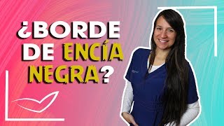Encías negras al rededor de coronas y carillas dentales l Bordes de encías con lineas negras