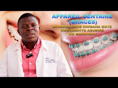 NI NDE UKENEYE APPAREIL (Braces) ZISUBIZA AMENYO KU MURONGO? BITWARA IGIHE KINGANA GUTE NGO UKIRE?