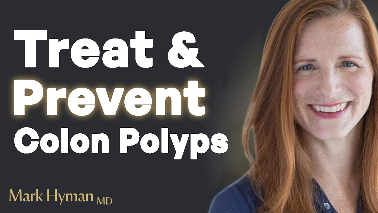 How To Treat And Prevent Colon Polyps Using Functional Medicine