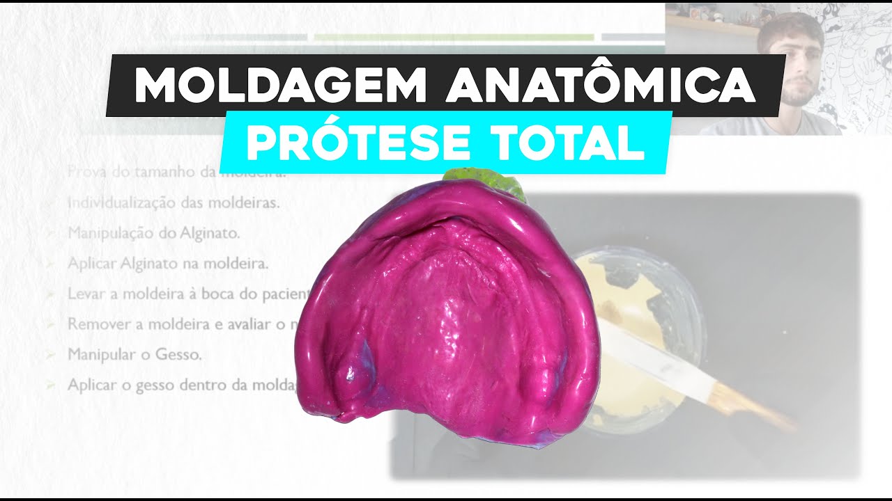 Moldagem Anatômica em Prótese Total: Técnicas e Dicas para um Resultado Perfeito!