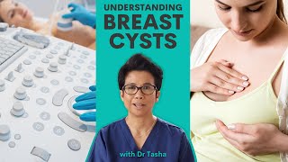 Understanding Breast Cysts - with Dr Tasha