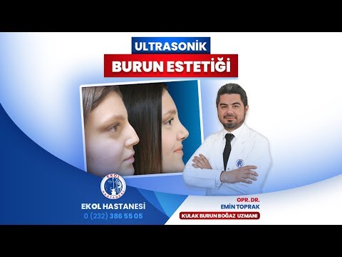 Ultrasonik Yöntemle Burun Estetiği - Opr. Dr. Emin Toprak - İzmir Ekol Hastanesi