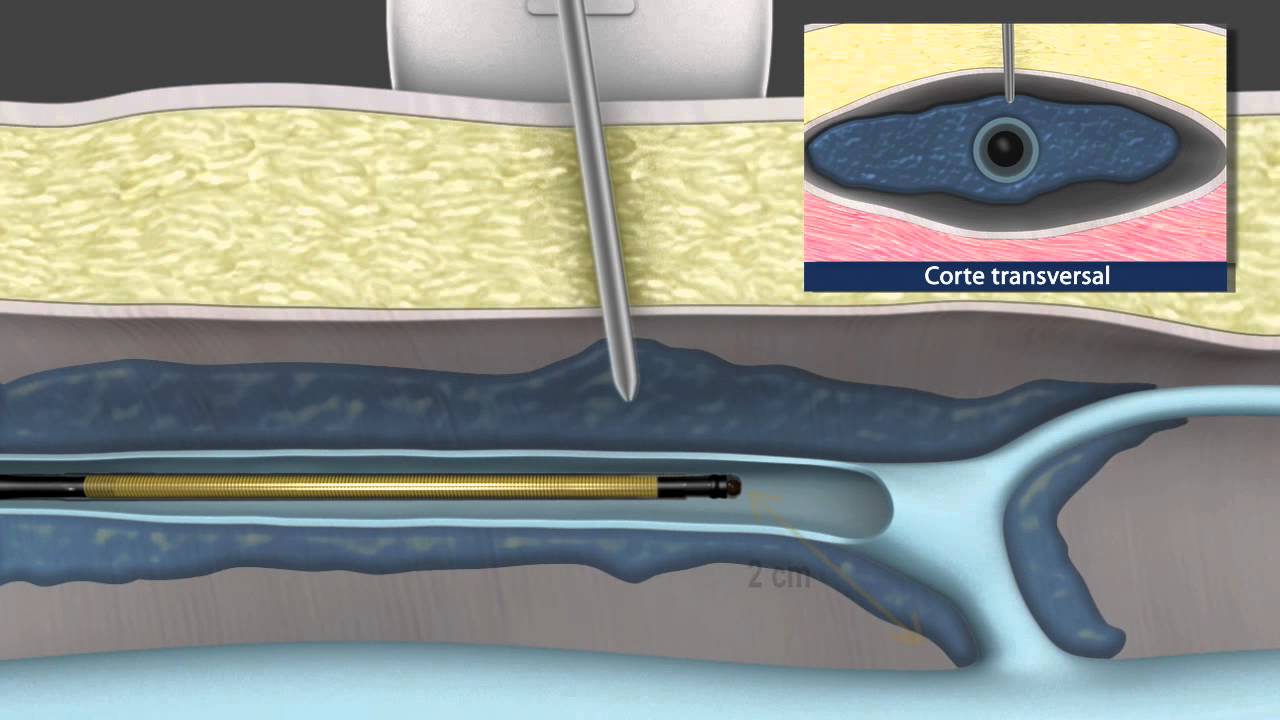 Jéfiton Cordeiro Jr-1