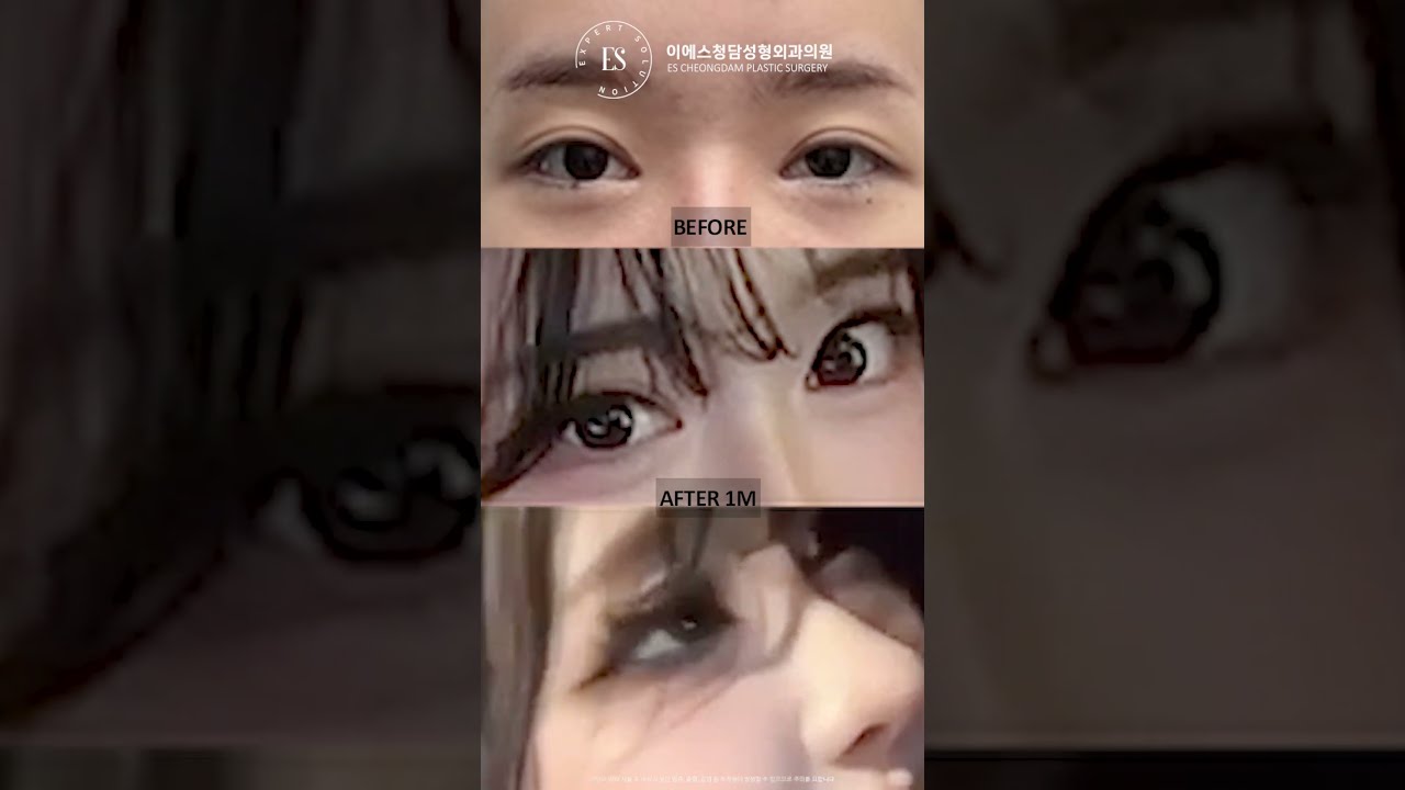 이에스 유튜브