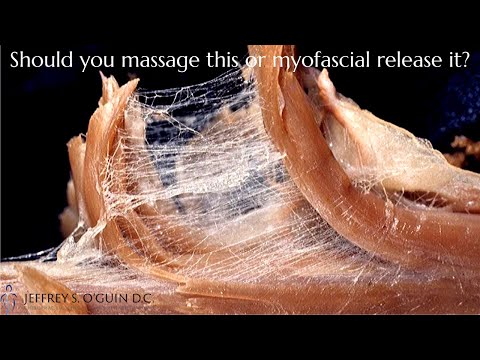 What is myofascial release | What's the difference between myofascial release vs. massage