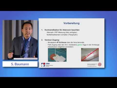 Korrekte Durchführung der FFR iFR Baumann