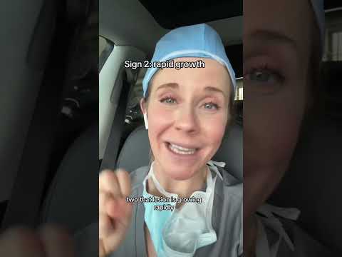 Don’t miss these 3 signs of skin cancer from board certified dermatologist #skincancer