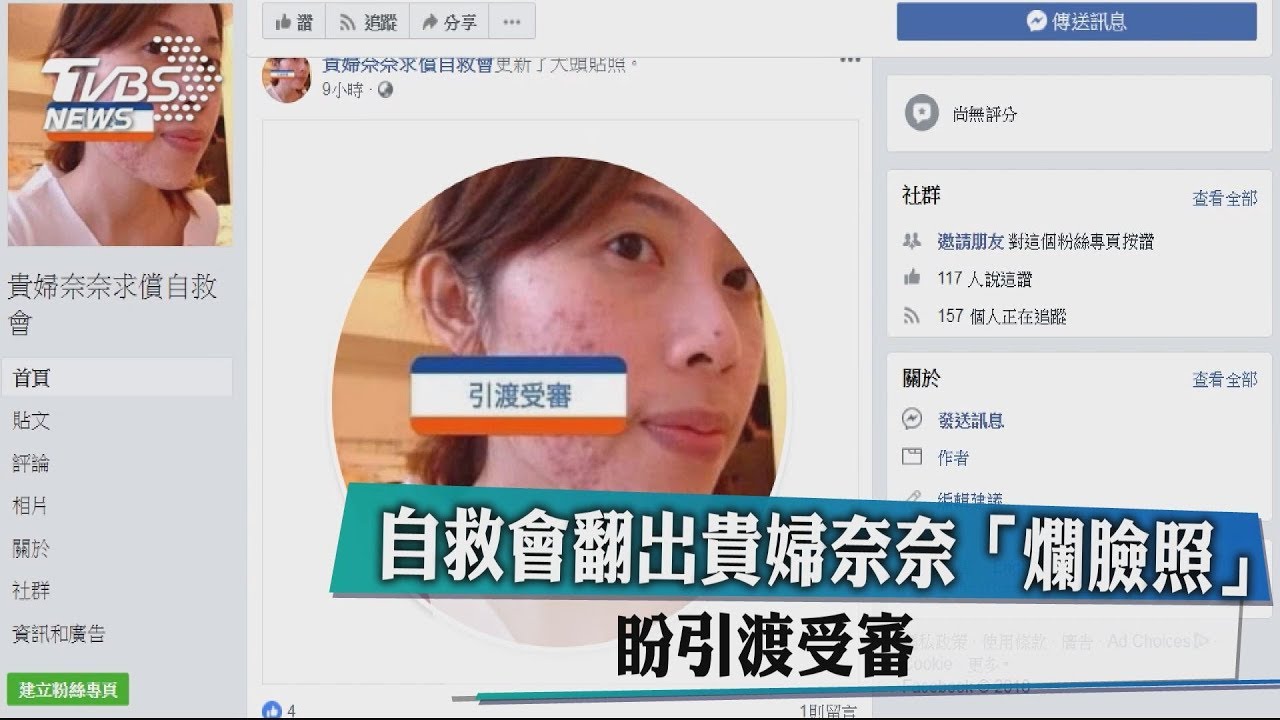 自救會翻出貴婦奈奈「爛臉照」 盼引渡受審