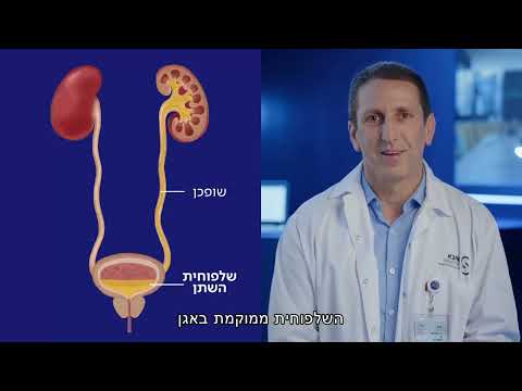 רופא ישראלי מסביר על הכליות, אבנים בכליות ואיך מטפלים בהן