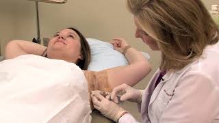Botox for Underarm Sweating (Hyperhidrosis) - by Dr. Lori Stetler