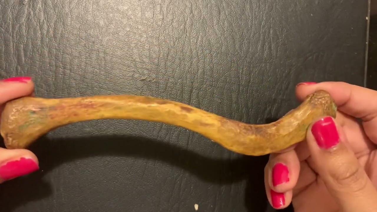 Bony Features of Clavicle | Charecteristics of Clavicle | Viva Questions | Lateral & Medial Part 2