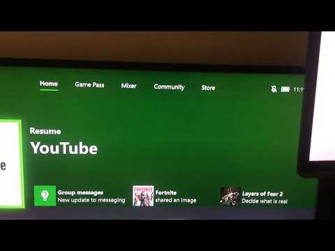 download lagu mp3 mp4 How To Turn Off Recurring Billing On Xbox One, download lagu How To Turn Off Recurring Billing On Xbox One gratis, unduh video klip How To Turn Off Recurring Billing On Xbox One