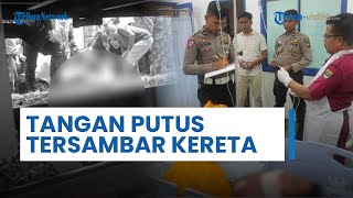 Bocah 10 Tahun Harus Kehilangan Tangan, seusai Tertabrak Kereta Api di Kota Pariaman