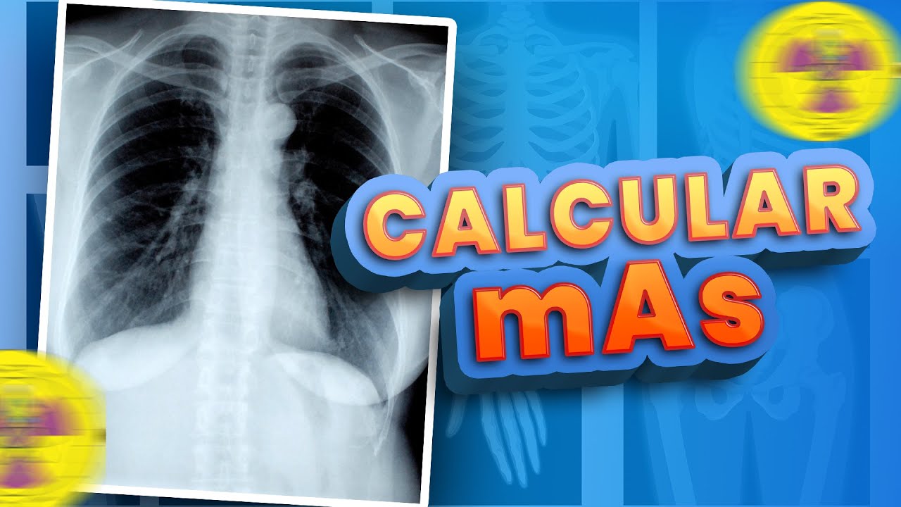 LEARN HOW TO CALCULATE mAs RIGHT NOW | Radiologizing