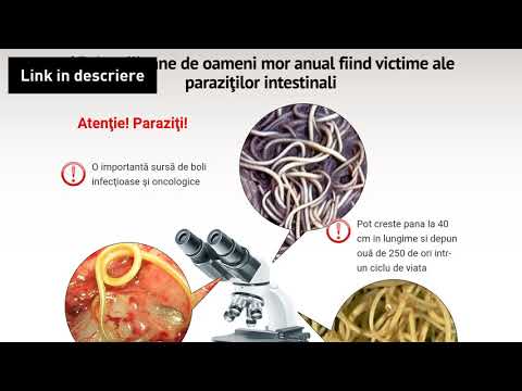 intraductalis papillomatosis szövettan